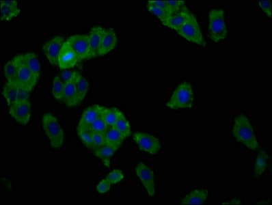 SLC7A1 / CAT1 Antibody