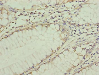 TRIM31 / RNF Antibody