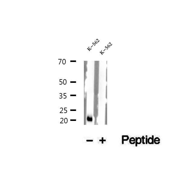 NDUFS7 Antibody