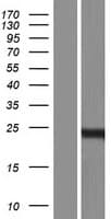 PRR5L / FLJ14213 Protein (Over-Expression Lysate Myc-DDK (Flag))