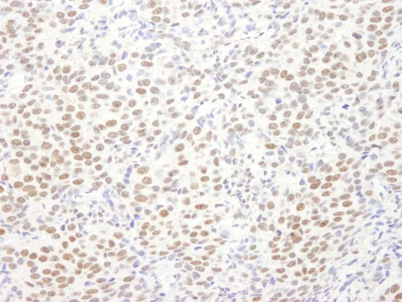 EWSR1 / EWS Antibody (aa100-150)