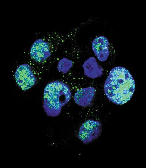 NOS3 / eNOS Antibody (phospho-Ser1177)