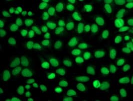 FGFR2 / FGF Receptor 2 Antibody (clone OTI2D1)