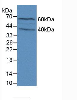 FLG / Filaggrin Antibody (aa119-336, PE)