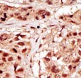 Polyclonal Rabbit anti-Human PRPK / TP53RK Antibody (aa220-249, IHC, WB)