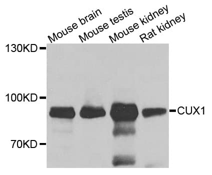 IHC-plus™ Polyclonal Rabbit anti-Human CUX1 / CASP Antibody (IHC, WB)