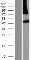 NHLRC3 Protein (Over-Expression Lysate Myc-DDK (Flag))