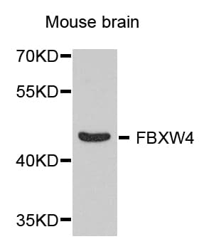 SHFM3 / FBXW4 Antibody