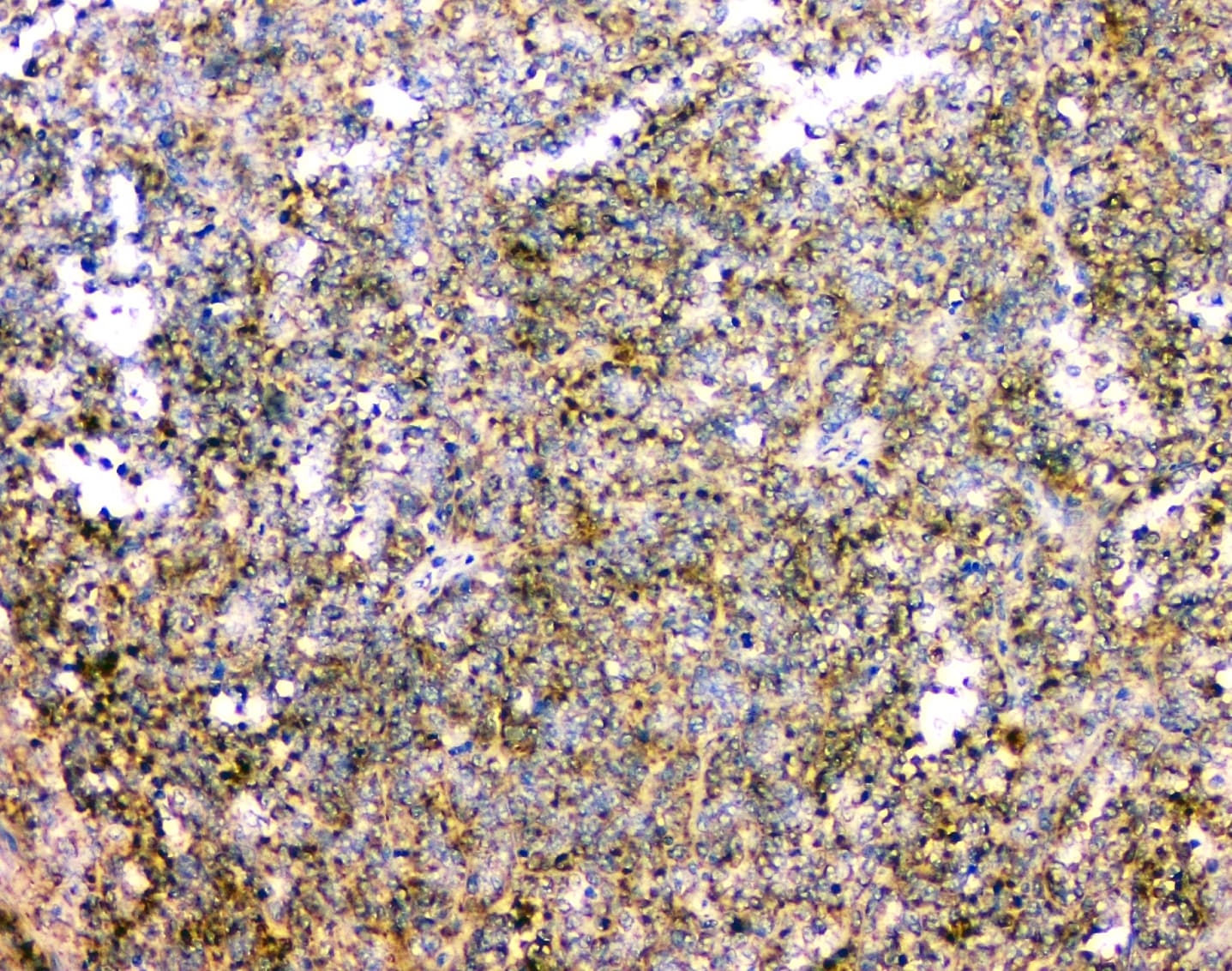IFN Gamma / Interferon Gamma Antibody