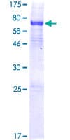 Human ALKBH5 Protein (Recombinant GST, N-terminus)