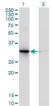 PDYN / ProDynorphin Antibody (clone 2E12)