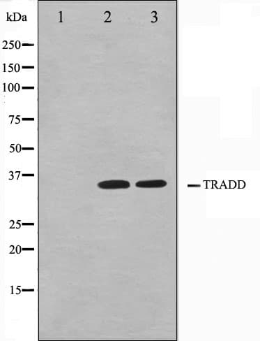 Polyclonal Rabbit anti-Human TRADD Antibody (IHC, IF, WB)