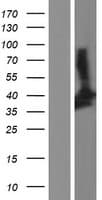 SIRT2 / Sirtuin 2 Protein (Over-Expression Lysate Myc-DDK (Flag))