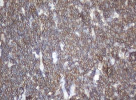 CD20 Antibody (clone OTI10A5)