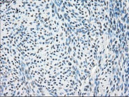 PPP5C Antibody (clone OTI6C2)