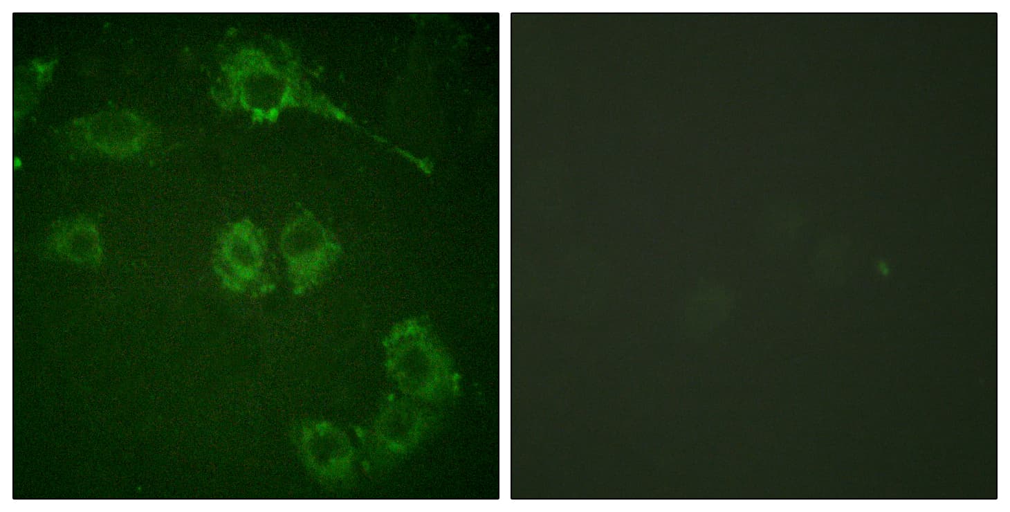 Polyclonal Rabbit anti-Human MAP3K8 / TPL2 Antibody (aa256-305, IHC, IF, WB)