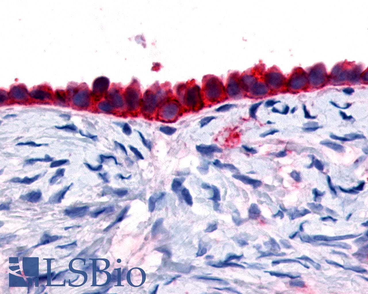 PathPlus™ ADGRD1 / GPR133 Antibody (Cytoplasmic Domain)