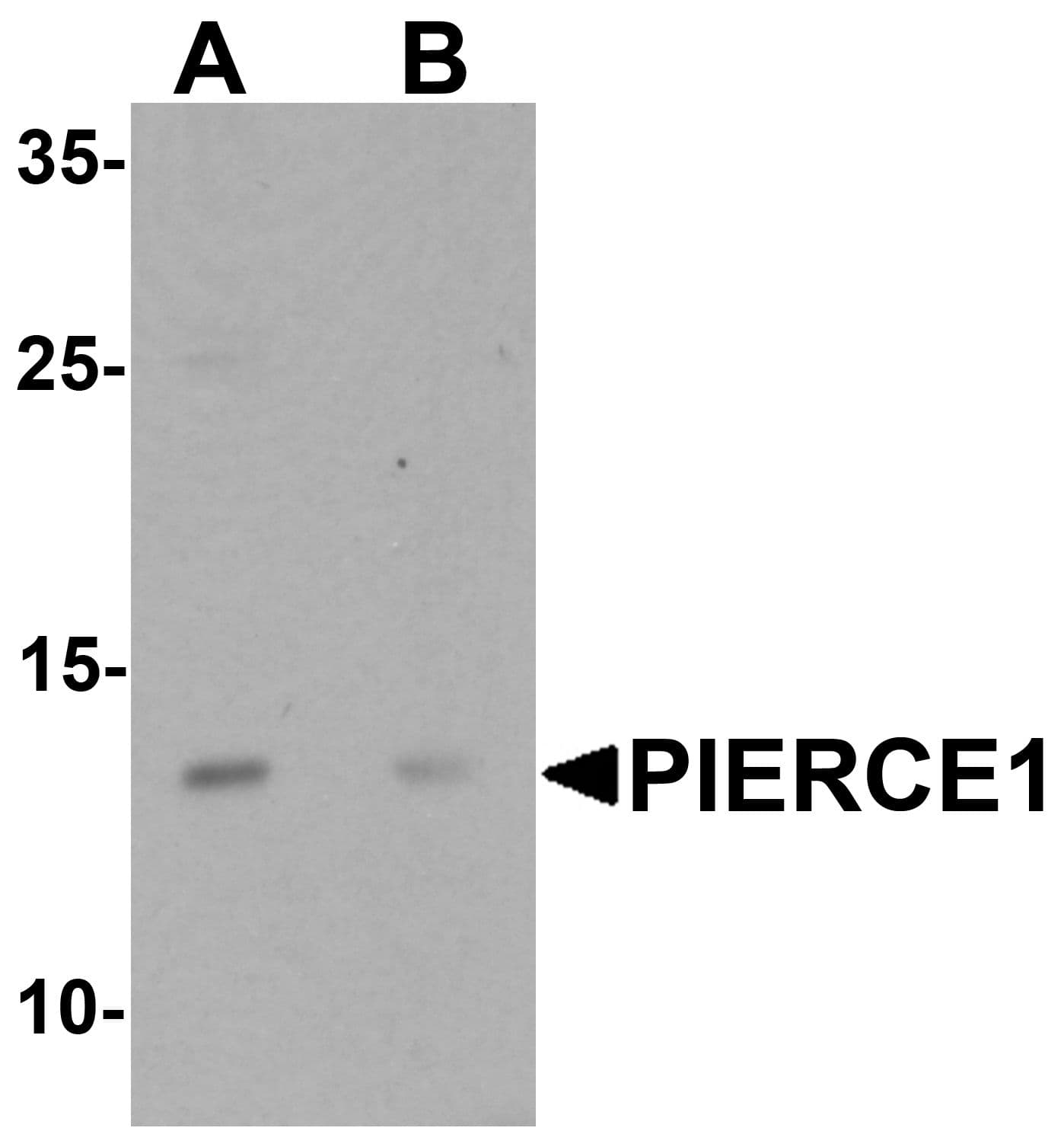 IHC-plus™ Polyclonal Rabbit anti-Human C9orf116 Antibody (IHC, WB)