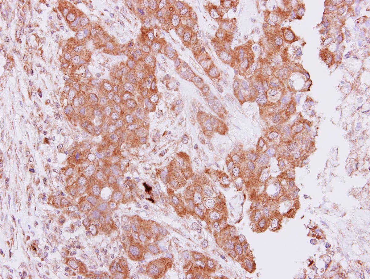 PIM2 / Pim-2 Antibody (aa53-278)
