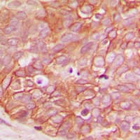 CTNNB1 / Beta Catenin Antibody (phospho-Ser33)