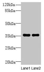 Polyclonal Rabbit anti-Human NAIF1 Antibody (IHC, WB)