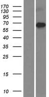 IKZF4 / EOS Protein (Over-Expression Lysate Myc-DDK (Flag))
