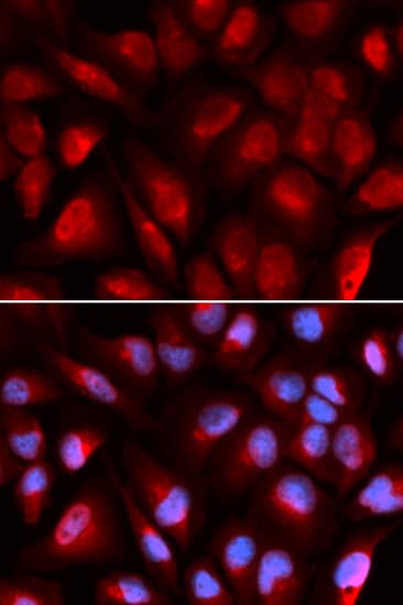 Polyclonal Rabbit anti-Human MCM5 Antibody (IHC, IF, WB)