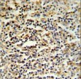 CCDC101 Antibody (aa179-208)