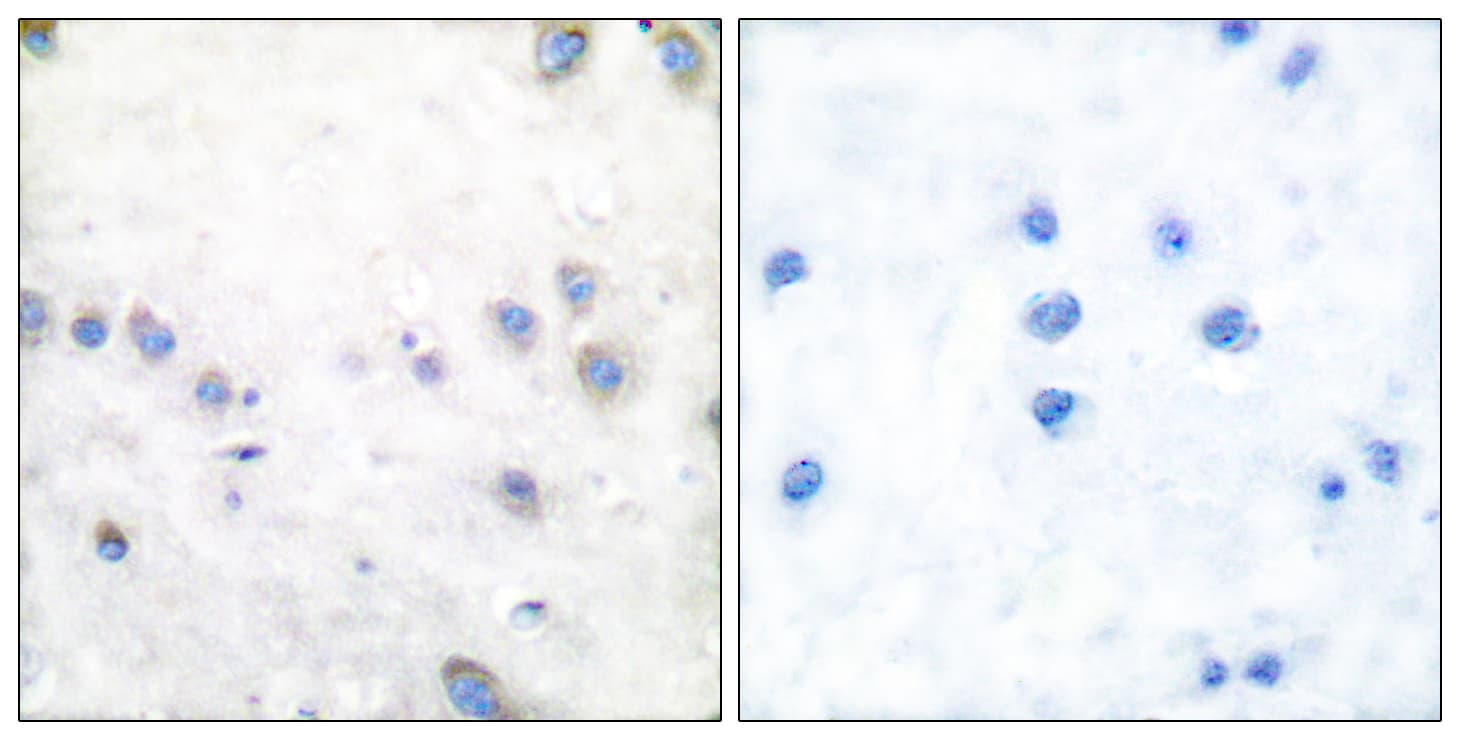 MAP3K8 / TPL2 Antibody (phospho-Thr290)