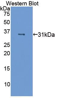 F13A1 / Factor XIIIa Antibody (aa140-377, Cy3)