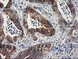 SULT1C2 / Sulfotransferase 1C2 Antibody (clone OTI5A4)