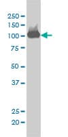 Monoclonal Mouse anti-Human CSE1L Antibody (clone 2C10, IF, WB)