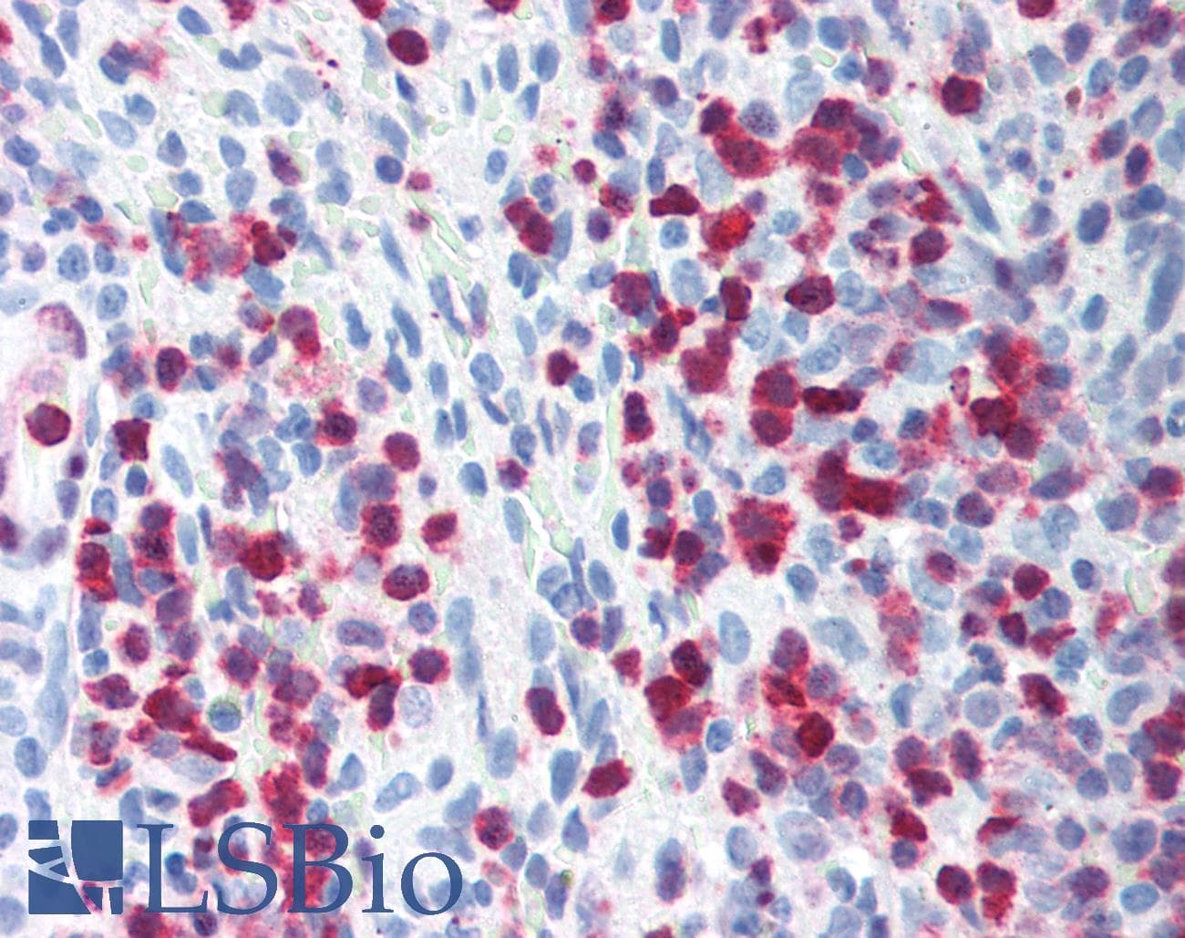 PathPlus™ S100A4 / FSP1 Antibody