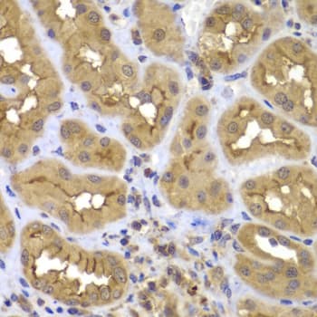 FASTK / FAST Antibody