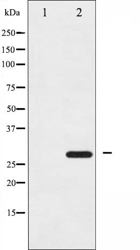 YWHAZ / 14-3-3 Zeta Antibody (phospho-Ser58)