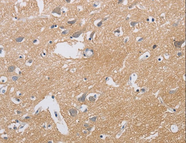 KCNMB3 Antibody (aa160-173)