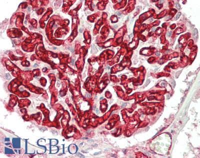 IHC-plus™ Polyclonal Rabbit anti-Human HLA-A Antibody (IHC, IF, WB)