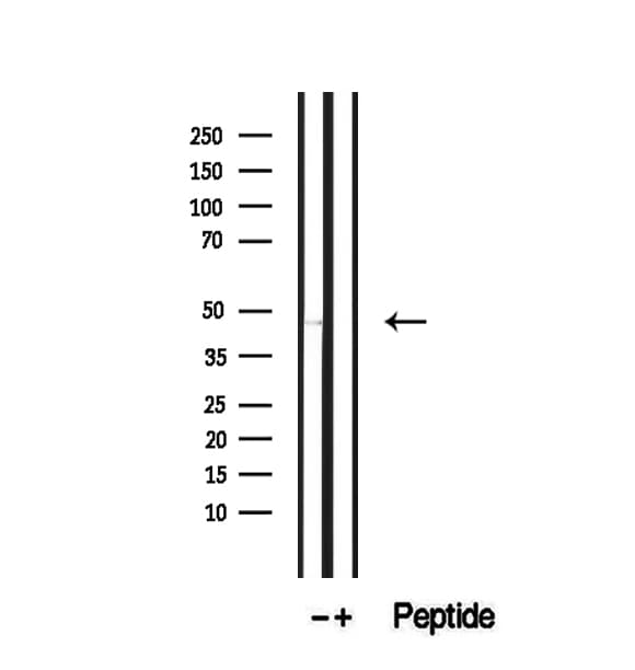 SLC25A46 Antibody