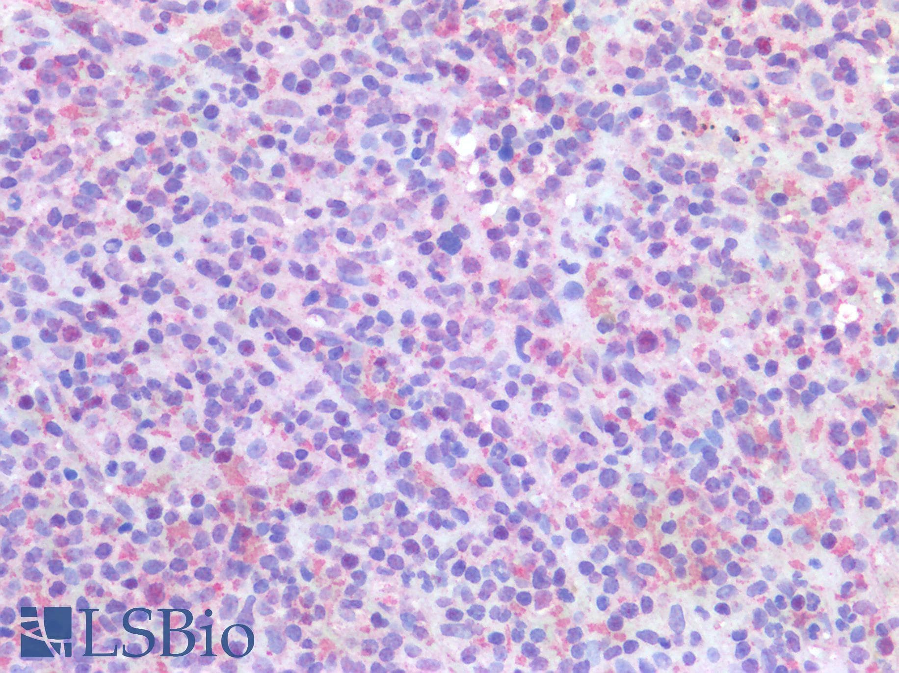 IHC-plus™ PIM1 / Pim-1 Antibody