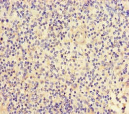 Polyclonal Rabbit anti-Human FGF13 Antibody