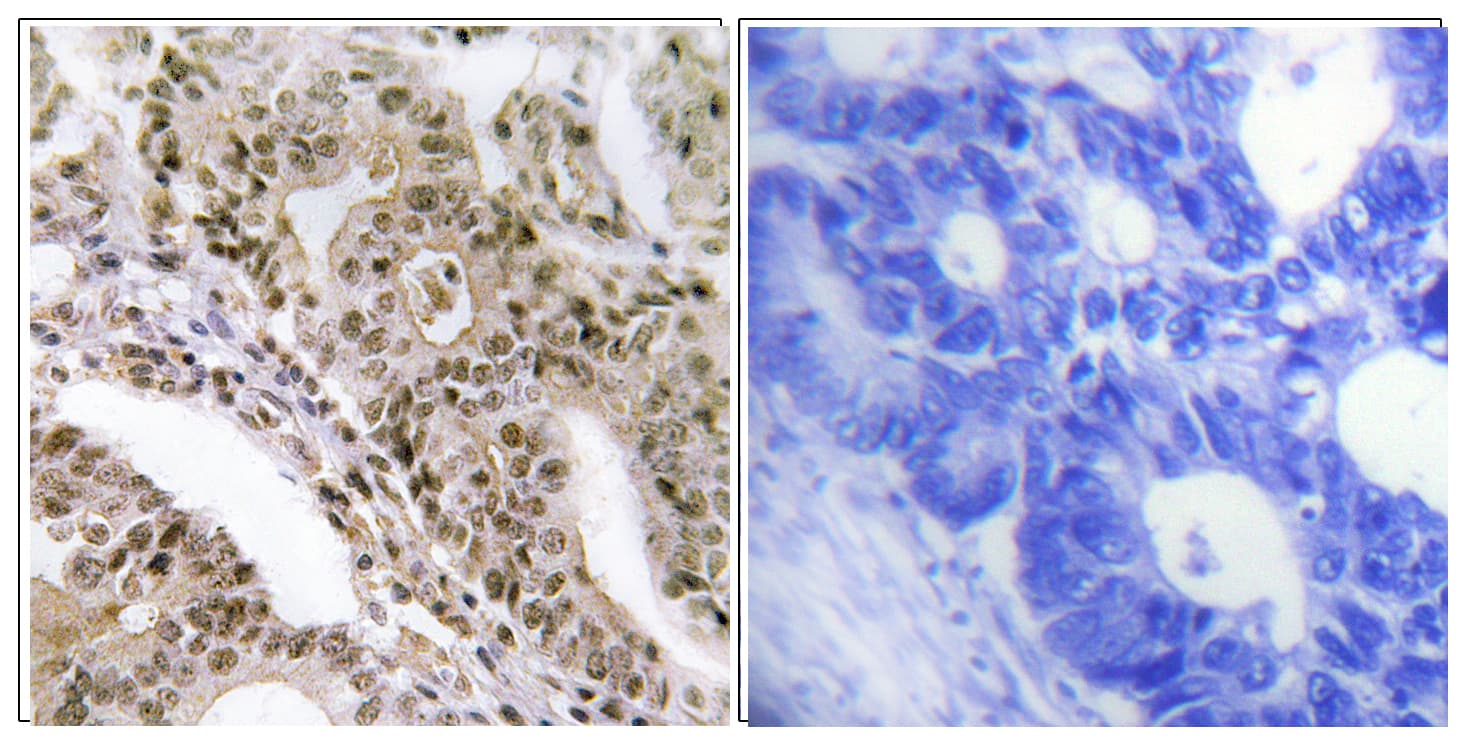 TBC1D4 / AS160 Antibody (phospho-Thr642)