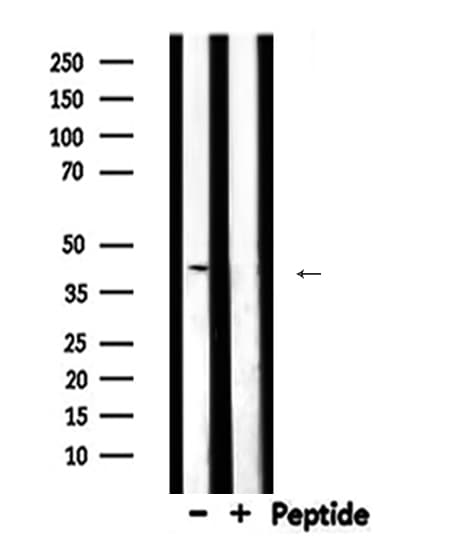 SERPINB5 / Maspin Antibody