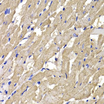 Mannose Phosphate Isomerase Antibody