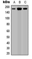 Polyclonal Rabbit anti-Human ROBO1 Antibody (Internal, WB)