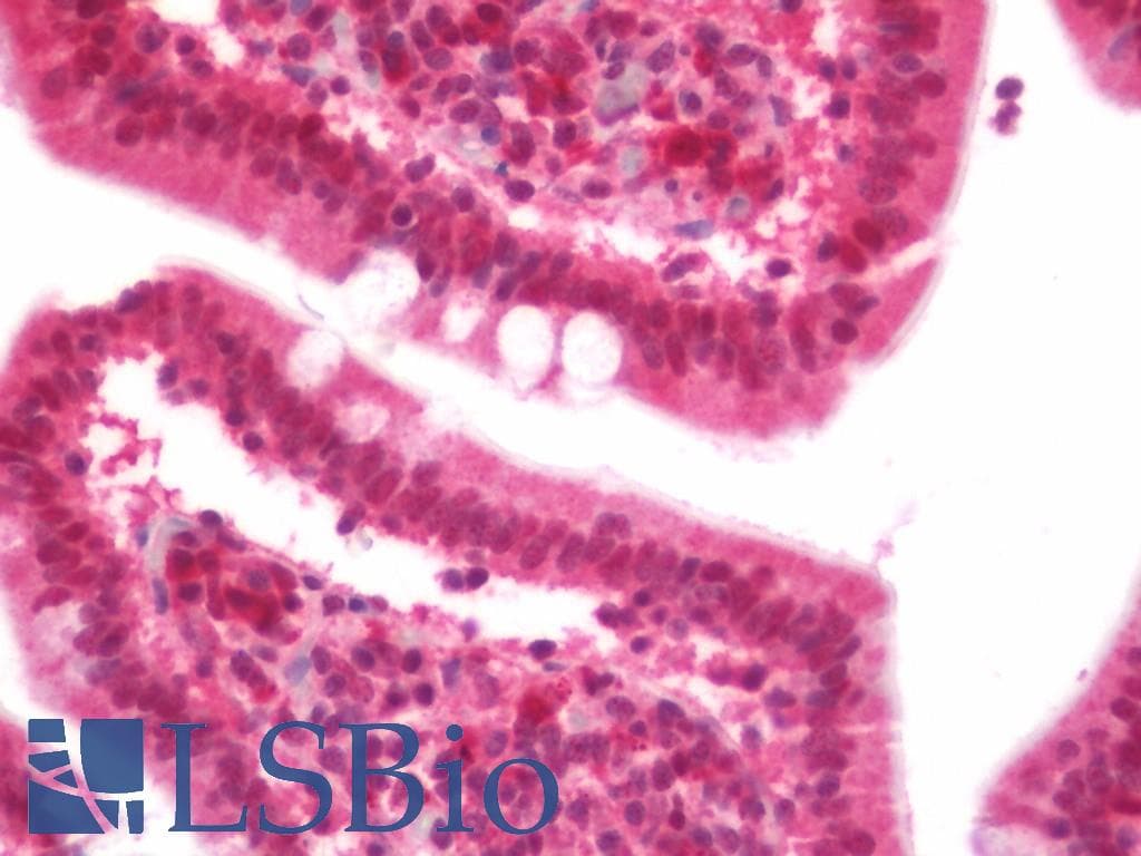 IHC-plus™ Polyclonal Rabbit anti-Human DTX4 Antibody (IHC, IF, WB)