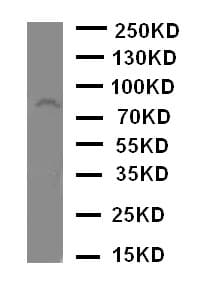 ADAM2 / Fertilin Beta Antibody (aa701-715)