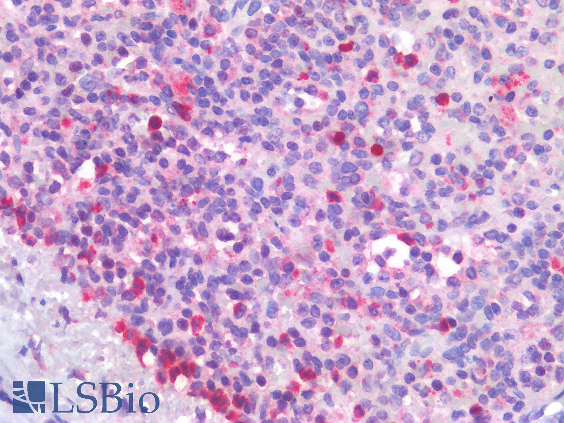 IHC-plus™ Polyclonal Rabbit anti-Human IL4 Antibody (IHC)