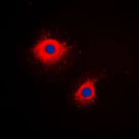 PathPlus™ KRT7 / CK7 / Cytokeratin 7 Antibody (C-Terminus)