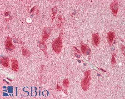 ANO10 / TMEM16K Antibody (aa470-519)