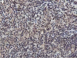 AKT1 Antibody (clone OTI3E3)